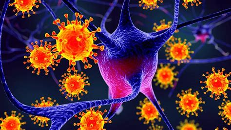 This material is provided for educational purposes only and is not intended for medical advice, diagnosis or treatment. Encefalitis herpética: Síntomas, causas y cómo tratar la ...