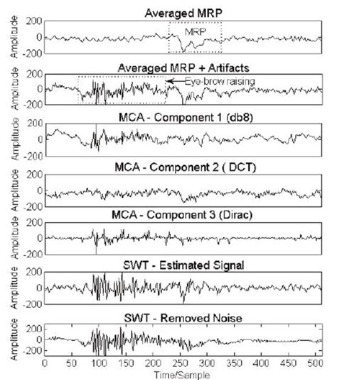 Decomposition Of The Eeg Signals Contaminated By Artifacts Caused By Download Scientific