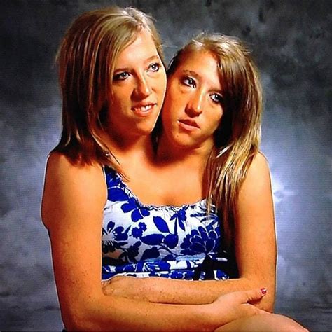 What Conjoined Twins Abby And Brittany Hensel Look Like Today