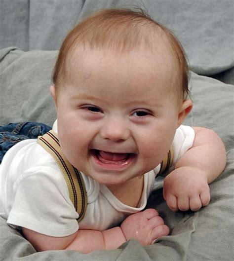 For centuries, people with down syndrome have been alluded to the national down syndrome society envisions a world in which all people with down. Down syndrome child is a special blessing:Inside Children's Blog