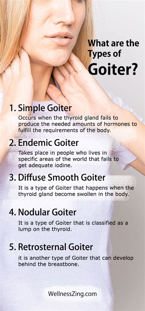 Goiter Treatment How To Shrink Goiter Naturally With Home Remedies