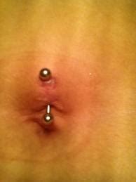 When your pierced belly button gets an infection, you will expect some signs and symptoms. Infected Navel Piercing - Symptoms, Signs, Swollen, How to ...