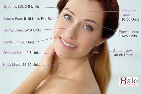 The more activity, usually the more botox that is needed. Botox for Wrinkles and Fine Lines - Halo Medicine