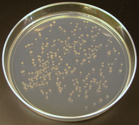 Li On Nutrient Agar Plates Growth Medium Microbiology