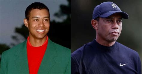 Tiger Woods Plastic Surgery Did His Wife Smash His Face Lee Daily
