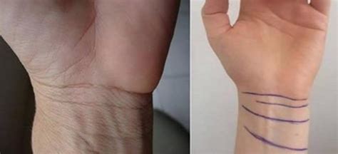 The Number Of Lines On Your Wrist Means A Lot More Than Youd Think Do