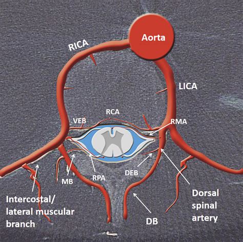 8 Thoracic Aorta And Major Branches Radiology Key