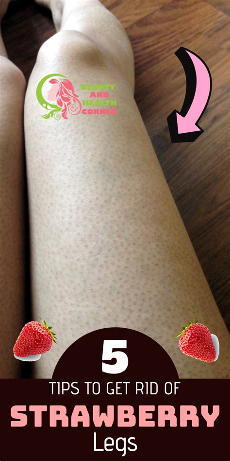 Untitled Strawberry Legs Diy Beauty Treatments Skin Remedies