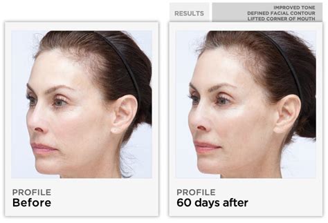 Shop the nuface lifter infusion serum 30ml from currentbody today. IveGotFashionitis: NuFace New You
