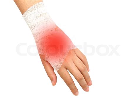 Hand Injury Wrist Strain Sprained In White Bandage Stock Image