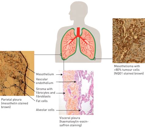 Representation Of The Normal Parietal Pleura The Visceral Pleura And