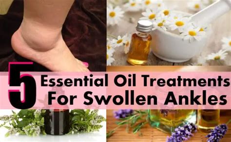 Essential Oils For Swollen Ankles Legs And Feet The Homestead Survival