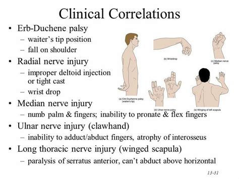Pin By Zahraa Munther On Medical Median Nerve Erb Palsy Radial Nerve