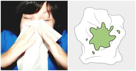 Mucus Color Meaning: 7 Different Colors You Need to Know ...
