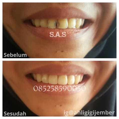 S.A.S - AHLI GIGI KOTA PATI, Jateng & KOTA JEMBER, Jatim: Koleksi Foto