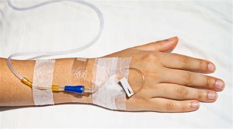 What Is A Peripheral Intravenous Line With Pictures