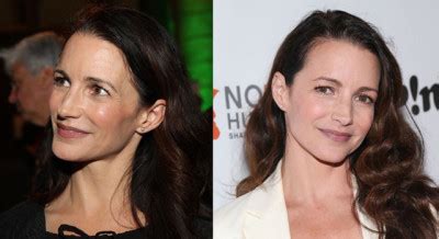 Kristin Davis Plastic Surgery Before And After Botox Injections Celebie