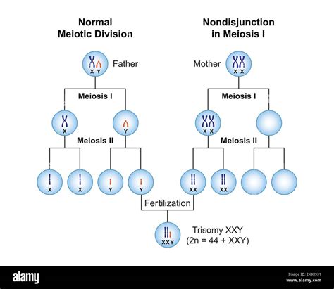 Scientific Designing Of Nondisjunction In Trisomy Xxy Klinefelter Syndrome Colorful Symbols