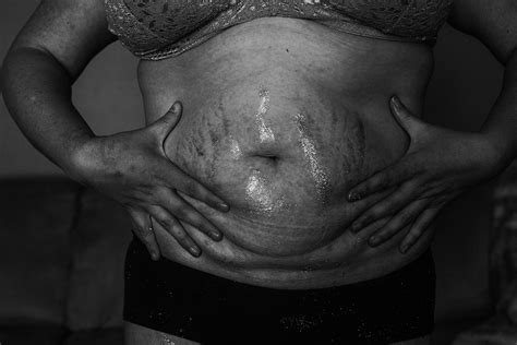 11 Photos That Capture The Beauty Of Postpartum Bodies Self