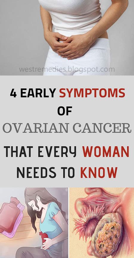 Learn about the signs and symptoms of ovarian cancer such as bloating, pelvic or abdominal (belly) pain, feeling full quickly, and urinary symptoms. 4 EARLY OVARIAN CANCER SYMPTOMS EVERY WOMAN NEEDS TO KNOW