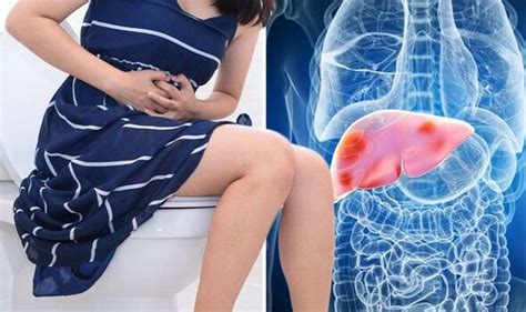 Woman 44 Spotted Dark Urine That Turned Out To Be Liver Disease Worldmedicinefoundation