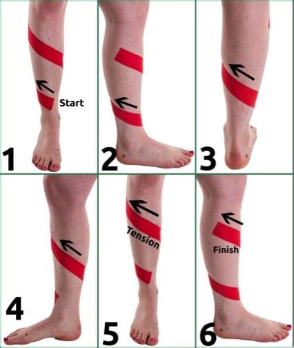 Shin Splint Taping A Guide To Strapping Your Shins To Help Shin Splints