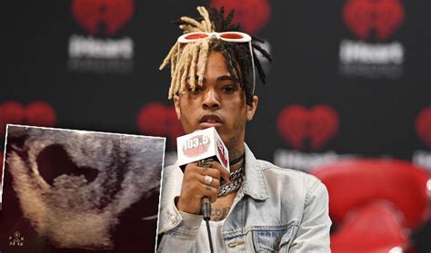 Keen to make a great first impression? XXXTentacion's Girlfriend Pregnant With His Child!