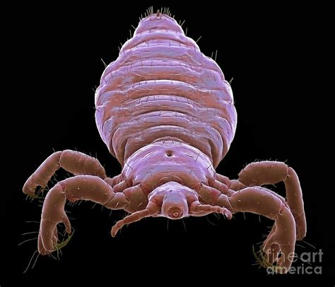 Head Louse Photograph By Steve Gschmeissnerscience Photo Library Pixels