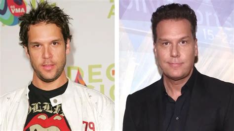 dane cook plastic surgery before and after photos