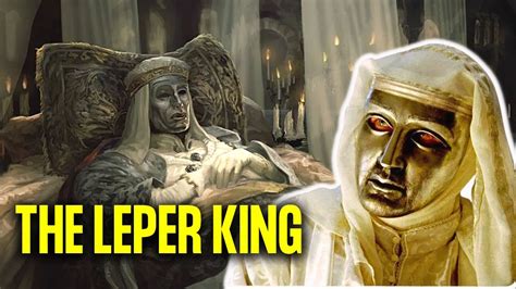 What Really Happened To The Leper King Baldwin Iv Of Jerusalem Youtube