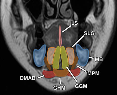 Postsurgical Imaging Of The Oral Cavity And Oropharynx What