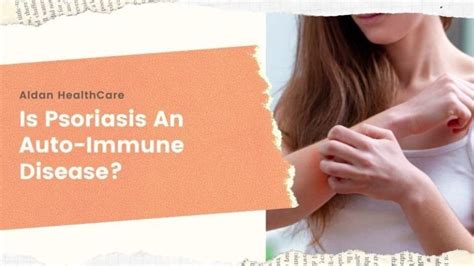 Is Psoriasis An Autoimmune Disease Know Here Psoriasis Treatment