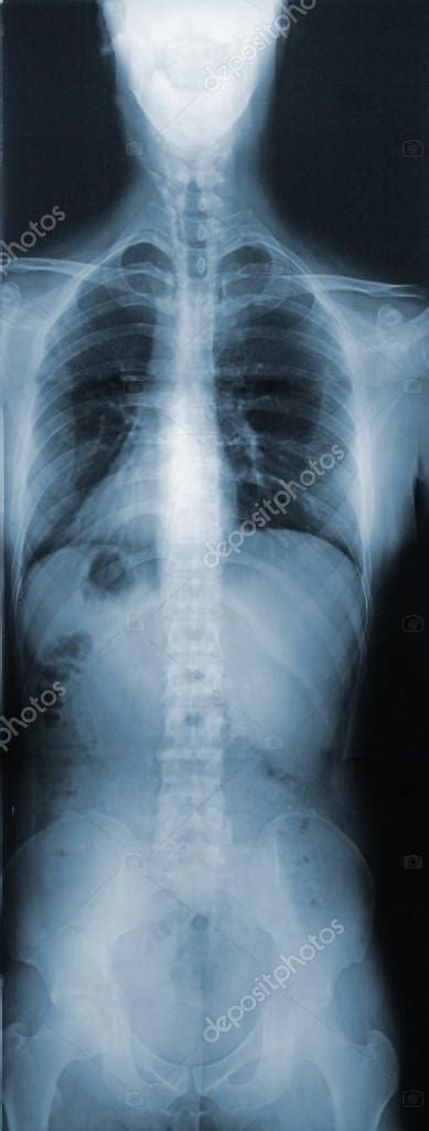 X Ray Of The Torso Stock Photo By ©jamesgroup 13457738
