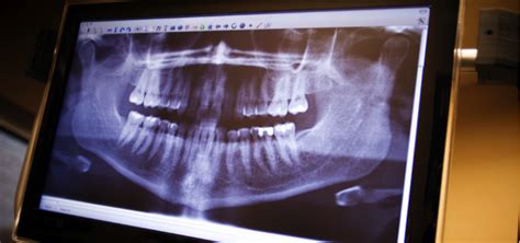 Abilene, tx dallas, tx midland, tx amarillo, tx odessa, tx plainview, tx new braunfels, tx slaton, tx allen, tx austin, tx. Home yourlubbockdentist.com