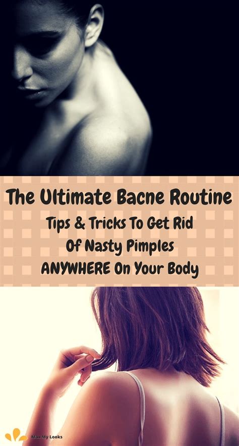 How To Get Rid Of Bacne Tips And A Routine That Works How To Cure