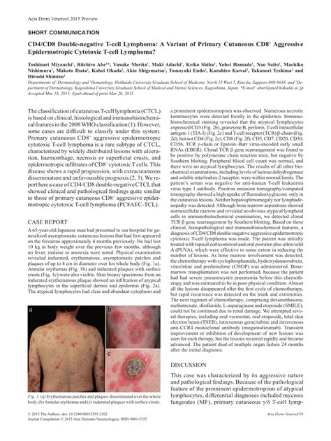 Pdf Cd4cd8 Double Negative T Cell Lymphoma A Variant Of Primary