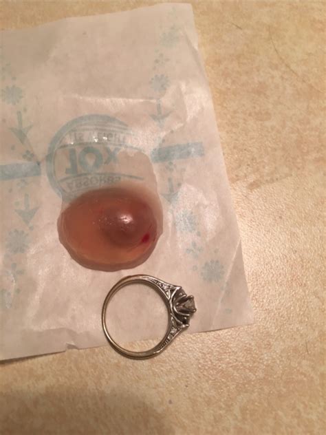 Miscarried At 8 Weeks Glow Community