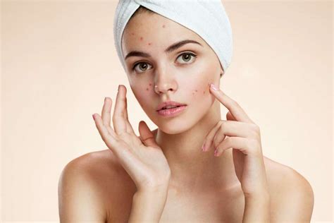 Acne Treatment Tucson Photodynamic Therapy Catalina Foothills