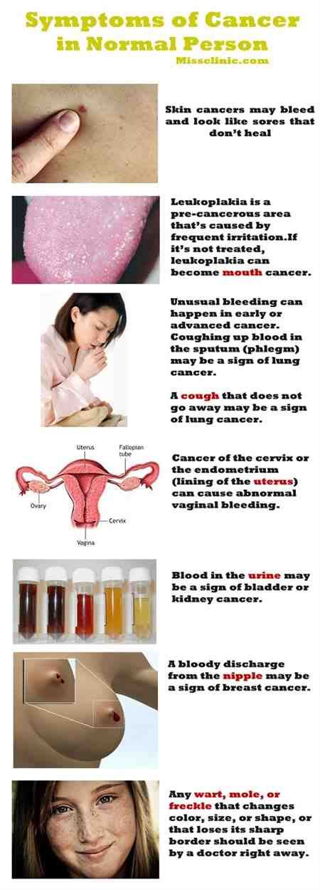 Ongoing abdominal pain or discomfort — including gas, indigestion, pressure, bloating and cramps — can signal ovarian or endometrial cancer. Excessive Bleeding Period Menopause Cancer Breast Maca ...