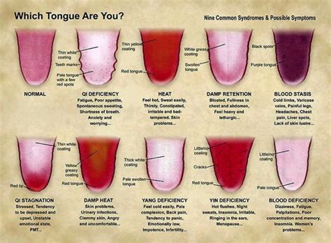 Brief Overview Of Chinese Tongue And Pulse Diagnosis Carolina Clinic