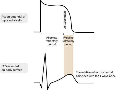 Figure 6 Myocardial Refractory Periods During The Action Potential