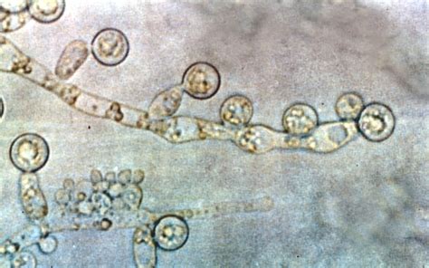162 Candida Albicans Fungus Fact Friday
