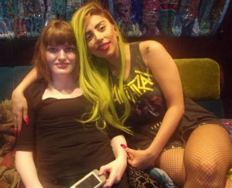 Welcome To Yugotee S Blog Be Inspired Lady Gaga Pays For Fan S Hip Surgery And Gives Her 24