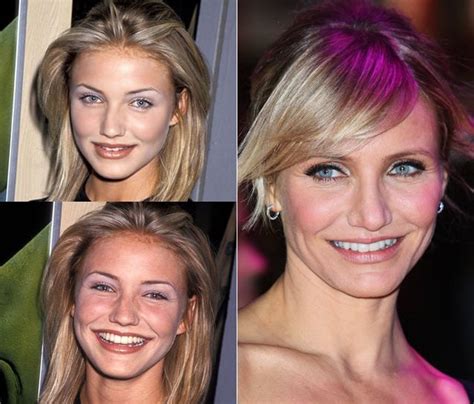 She has appeared in the south african versi. Antes e depois de alguns famosos que fizeram plástica no nariz, a rinoplastia