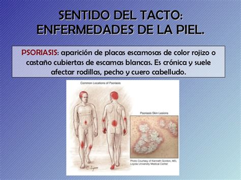 Enfermedades órganos De Los Sentidos