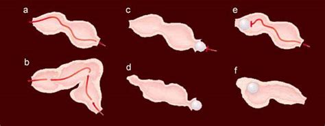 Two atria and a single ventricle. A Simple Heart | Natural History Magazine