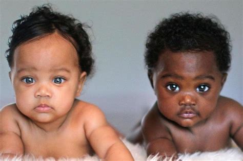 Twins With Different Skin Color