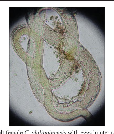 Capillariasis