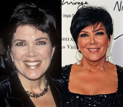 But then we did not know (what/do) what to do with the python. Kris Jenner Nose Job