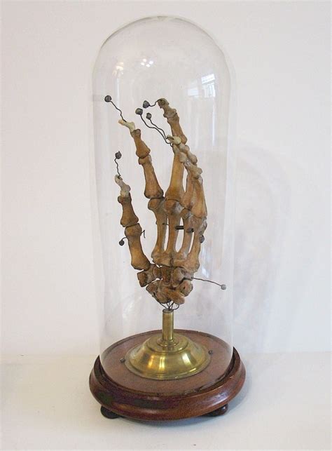 Anatomical Hand Late 19th C Medical Curiosities Vintage Oddities